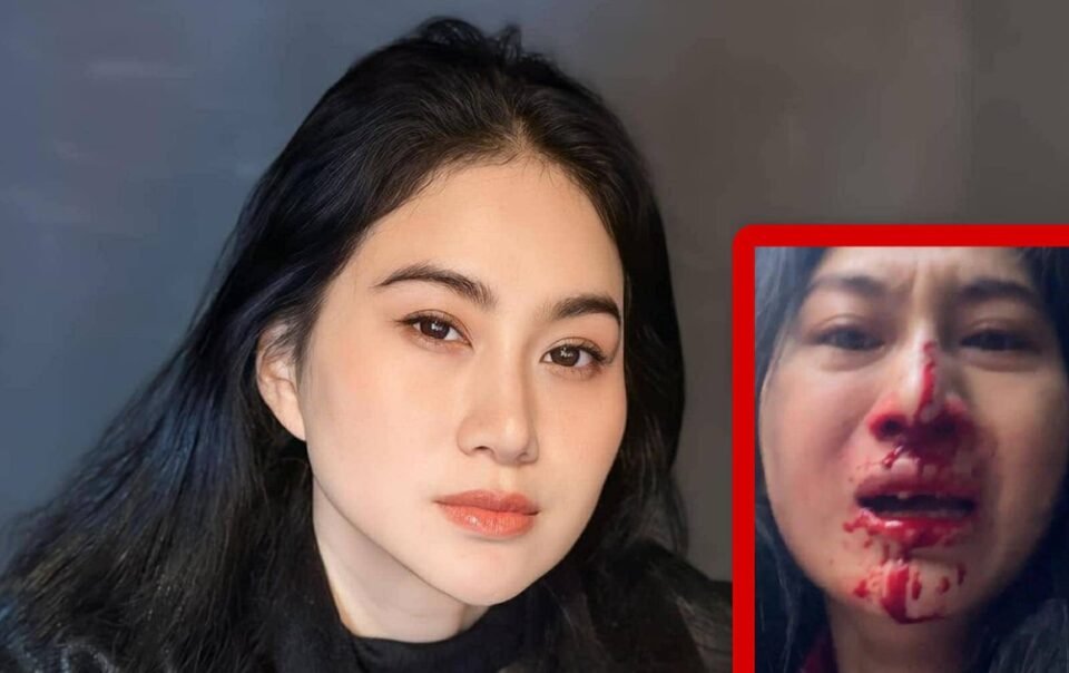 dien-vien-phi-ngoc-anh-mat-day-mau,-cau-cuu-tren-livestream