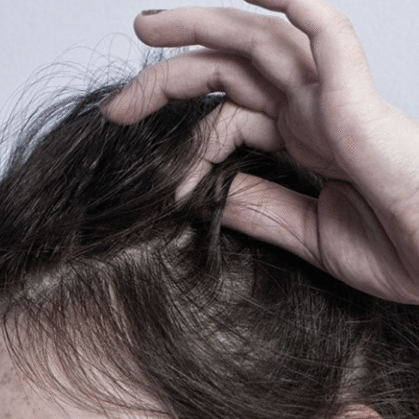 thoi-quen-thich-nho-toc-co-the-la-benh-ly-tam-than?