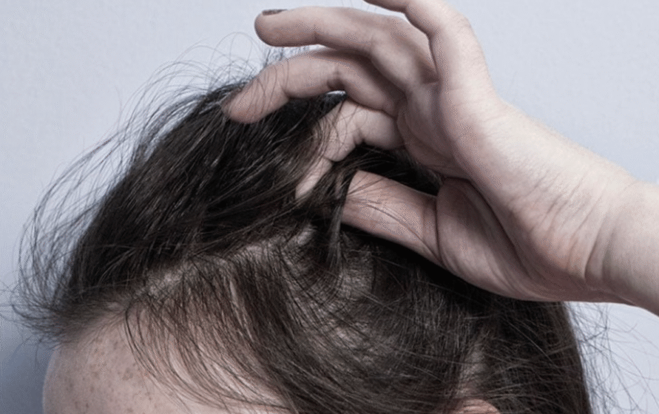 thoi-quen-thich-nho-toc-co-the-la-benh-ly-tam-than?