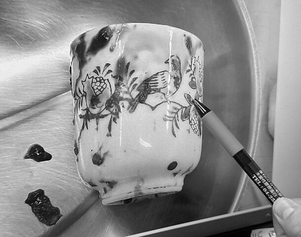 nguoi-dan-ong-hoai-tu-ruot-vi-chiec-coc-su-trong-hau-mon