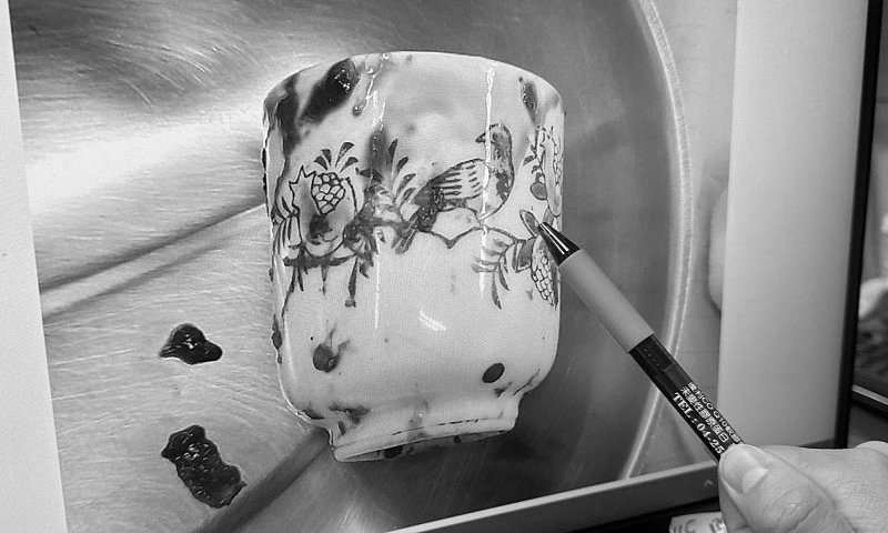 nguoi-dan-ong-hoai-tu-ruot-vi-chiec-coc-su-trong-hau-mon