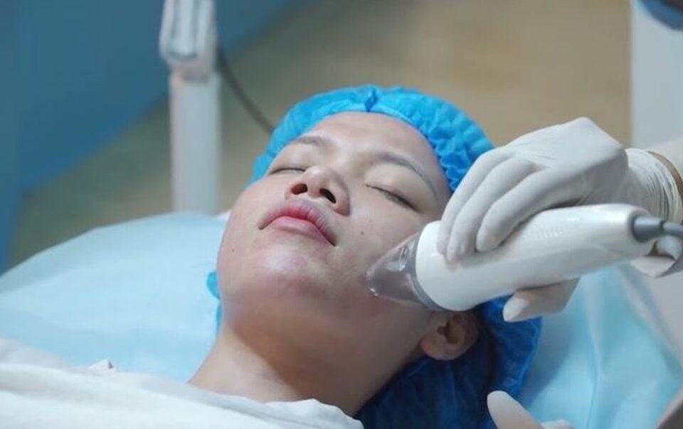 cold-plasma-co-gay-dau-hay-cham-chich-khi-ung-dung-trong-lam-sang?