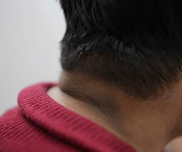 da-co,-nach-sam-mau-co-phai-dau-hieu-tieu-duong?