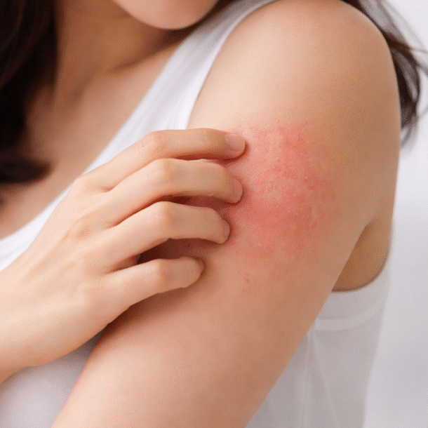 5-thay-doi-tren-da-co-the-canh-bao-benh-gan