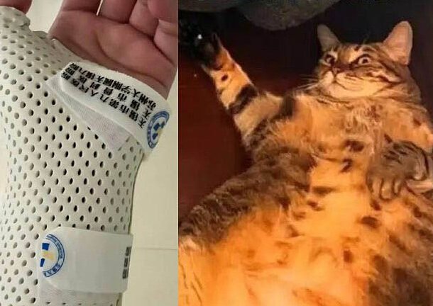 bi-meo-nang-7,5-kg-‘de’-khi-ngu,-co-gai-gay-xuong-co-tay