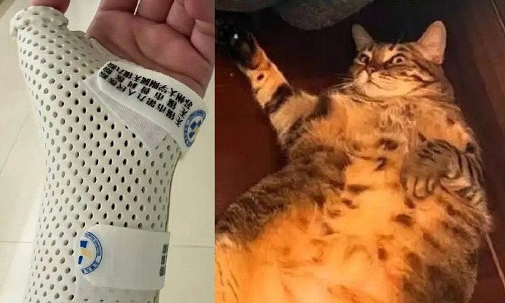 bi-meo-nang-7,5-kg-‘de’-khi-ngu,-co-gai-gay-xuong-co-tay