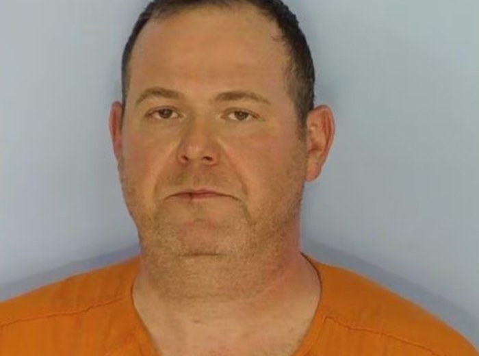 bac-si-my-bi-truy-to-do-cat-nham-gan-thay-vi-lach-benh-nhan