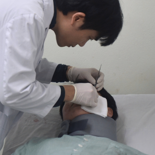 tiem-filler-tao-hinh-tai,-ba-nam-sau-co-gai-24-tuoi-bi-viem-nhiem,-ap-xe