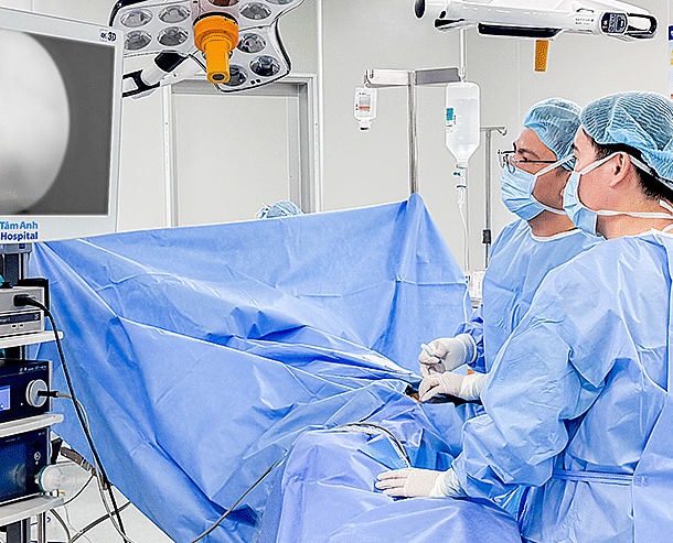 stent-nieu-quan-di-lech-len-than