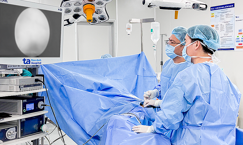 stent-nieu-quan-di-lech-len-than
